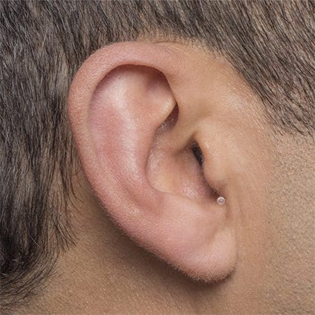 Invisible in-canal hearing aid style